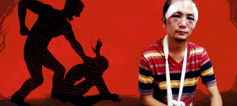 अफसोस लाल ब्रूस, तुम मरकर भी अखलाक नहीं बन सकते!